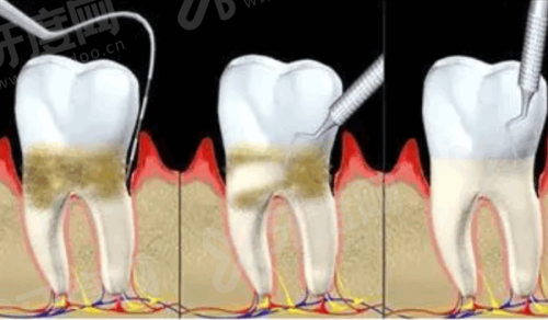 二、达州医附大口腔医院地址在哪里？总院在通川区朝阳东路 28 号yanke.yadoo.cn