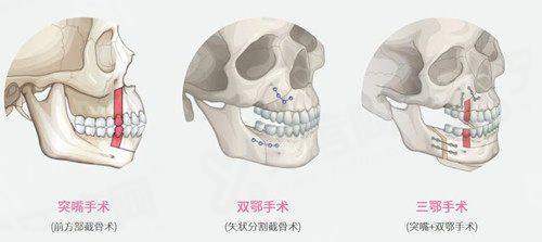 一、佛山曙光金子医学美容医院地址在哪里？（位于佛山市禅城区祖庙路XX号，交通便利）yanke.yadoo.cn