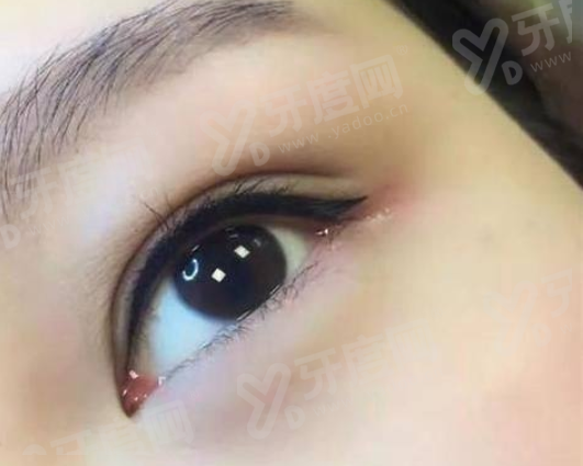 一、佛山曙光金子医学美容医院技术好吗？（技术实力雄厚，成效真实可靠）yanke.yadoo.cn