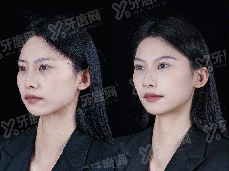 二、佛山曙光金子医学美容医院收费贵吗怎么样？yanke.yadoo.cn