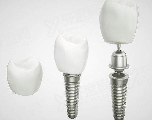 二、丹阳麦雅口腔预约挂号yanke.yadoo.cn