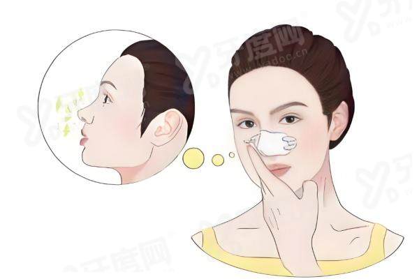 济南韩式王召东医生做隆鼻手术好吗？技术精湛风格自然，重塑立体美鼻首选