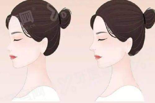 2026李世荣教授做阴茎手术价格表：1.28W+附预约挂号攻略与详细地址