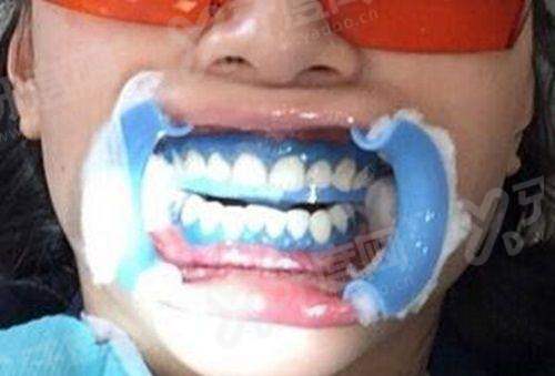 阿克苏旭日升口腔门诊部口碑评价怎么样？医生技术稳价格透明，真实反馈赞