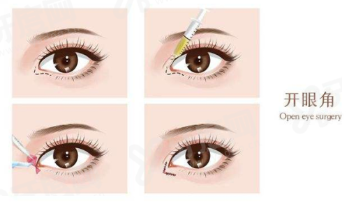 三、李世荣医生挂号攻略yanke.yadoo.cn