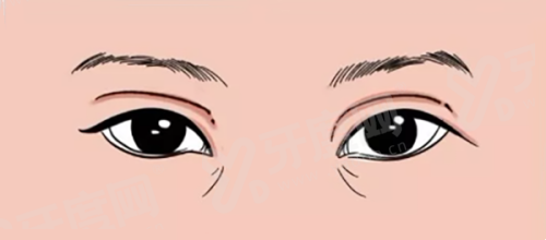 二、聂桥林医生注射爱贝芙多少钱yanke.yadoo.cn