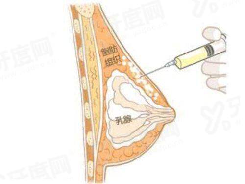 三、济南俏嘉丽整形医院地址在哪里yanke.yadoo.cn