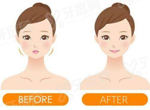 二、深圳非凡梅够明做鼻子多少钱？yanke.yadoo.cn