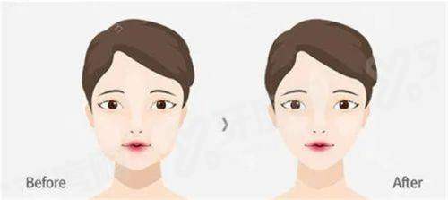 二、西安伊美尔医疗美容医院怎么样yanke.yadoo.cn