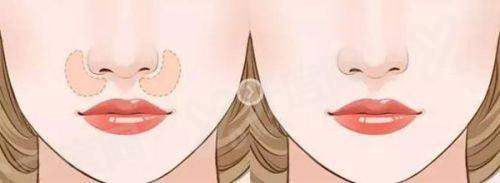 二、如何预约向少龙医生？在线预约或电话询问更便捷yanke.yadoo.cn