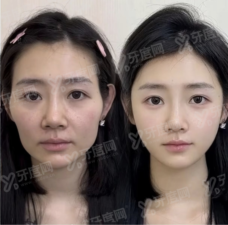 吉林市星范整形医院口碑怎么样？正规机构技术靠谱价格不贵，