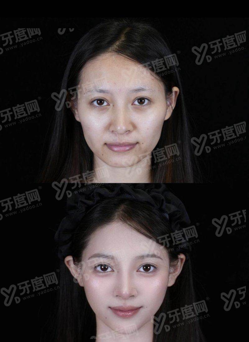 二、李世荣医生做阴茎手术预约挂号攻略yanke.yadoo.cn