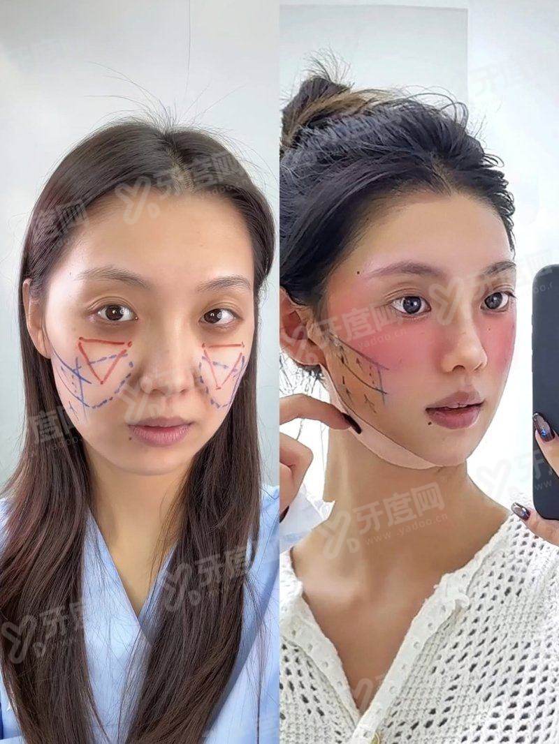 三、李世荣医生做阴茎手术地址在哪里yanke.yadoo.cn