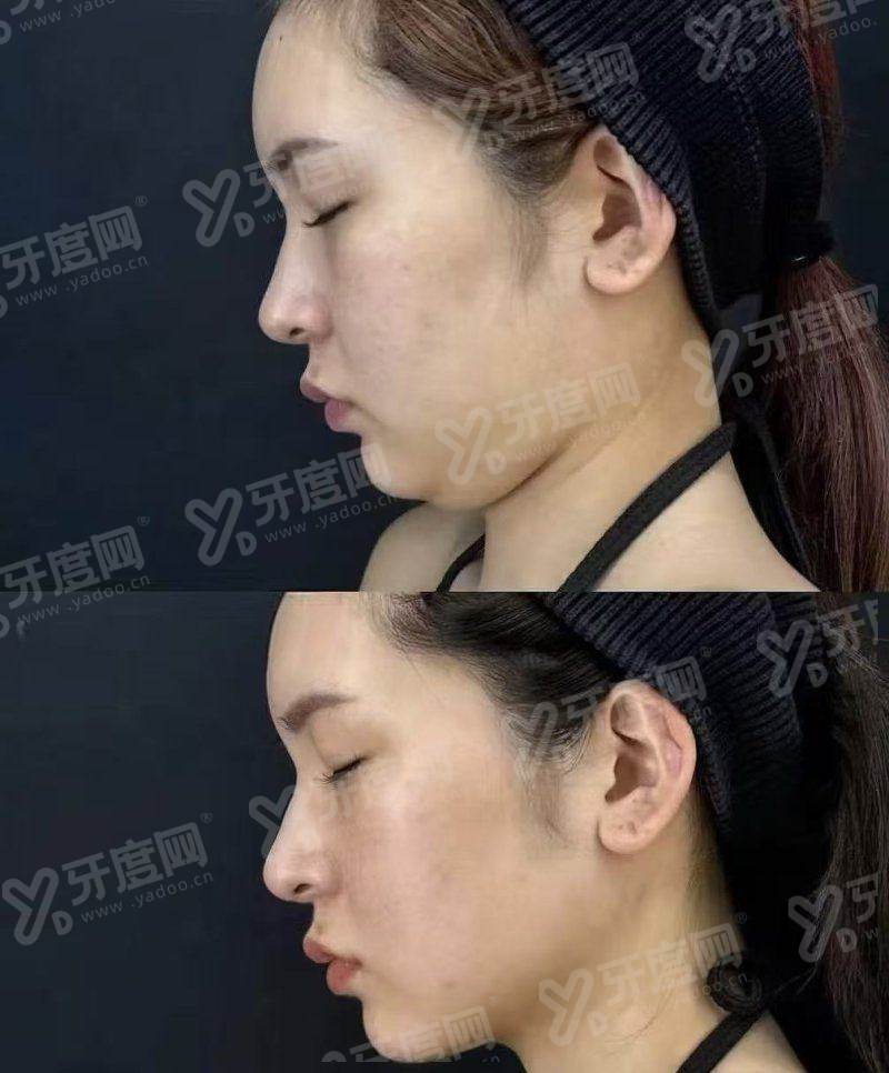 李世荣做阴茎手术在哪个医院？在重庆西南，价格1.68W起附挂号攻略