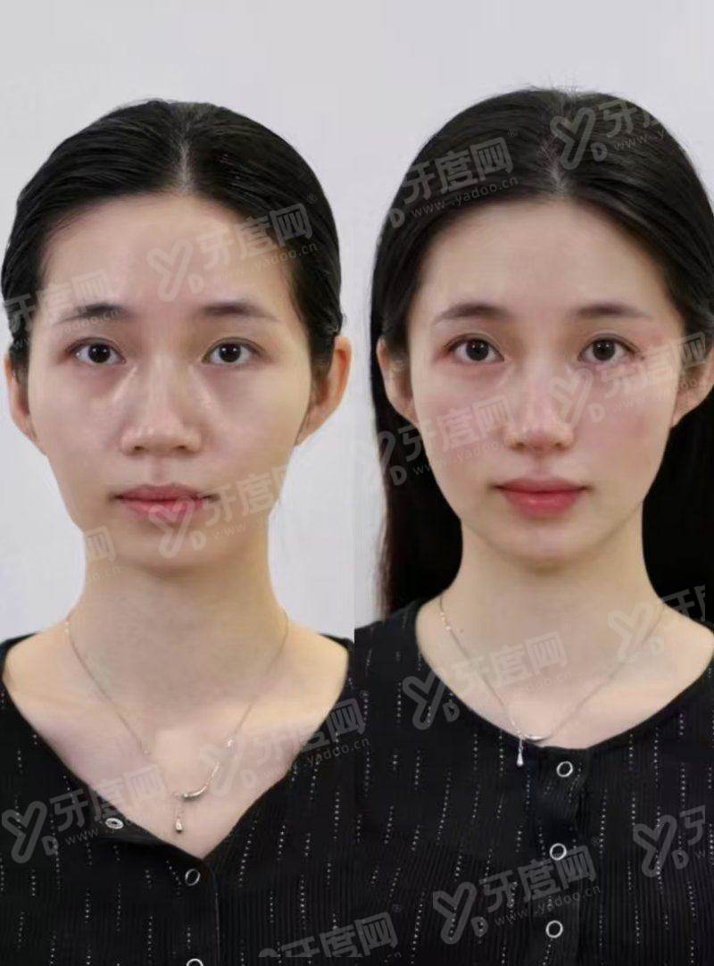 西安亚美雁塔医疗美容诊所怎么样？赵银巧医生作为诊所的主治医生，担纲领队重任。