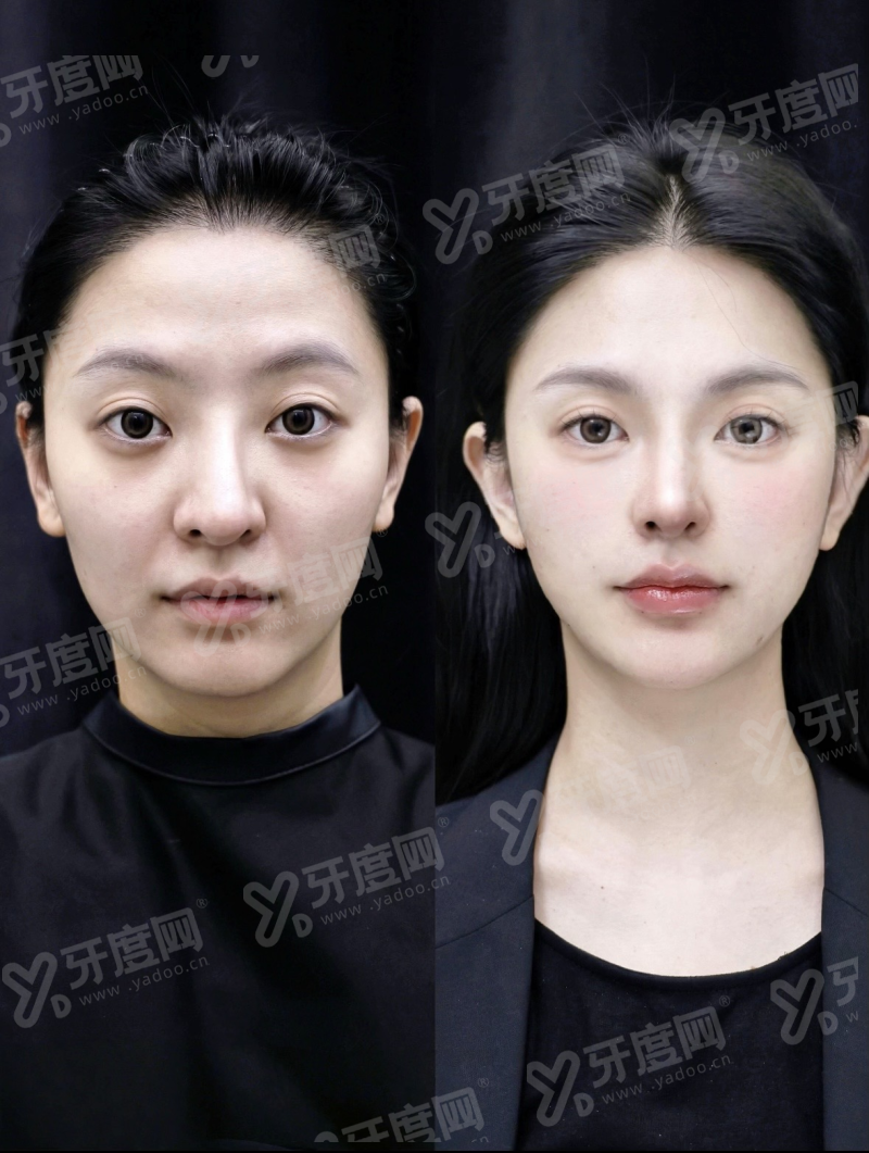 三、吉林市星范整形医院怎么样yanke.yadoo.cn