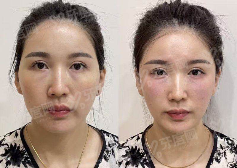 西安伊美尔医疗美容医院地址电话：在碑林区南大街，整形价格不贵