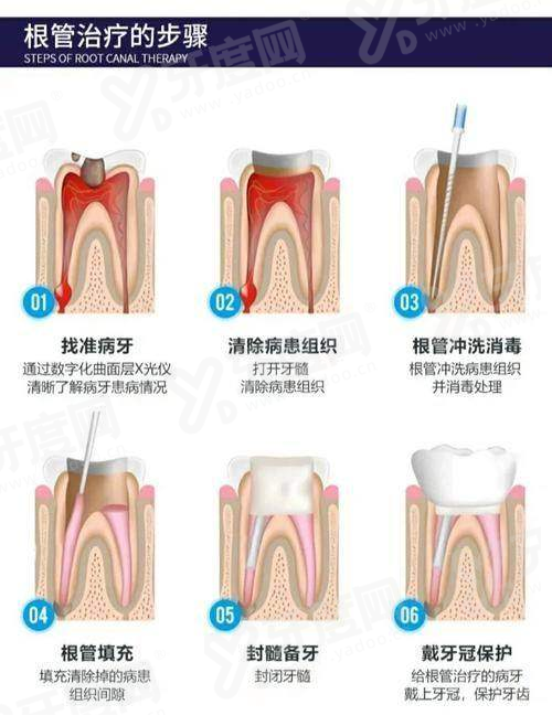 二、深圳友睦口腔预约挂号yanke.yadoo.cn