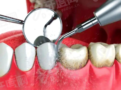 三、深圳友睦口腔收费价格表yanke.yadoo.cn