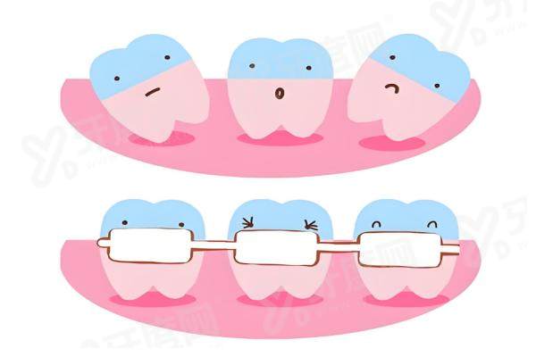 西安圣贝口腔医院牙齿矫正价格是多少？金属托槽矫正8800元起+隐形矫正16800元起，技术靠谱收费透明