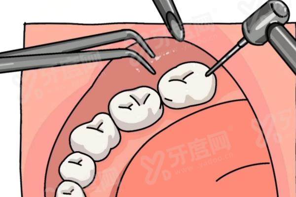 西安圣贝口腔医院能刷医保吗？治疗可用余额，价格表透明无隐形消费