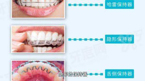 广州柏德口腔看牙可靠吗？德系种植技术精准，价格透明预约便捷放心选