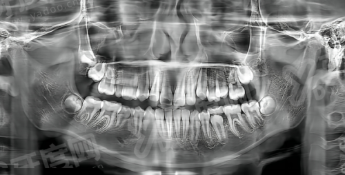 烟台龙口德韩口腔是正规医院吗？资质正规医生持证，种植/矫正价格不贵