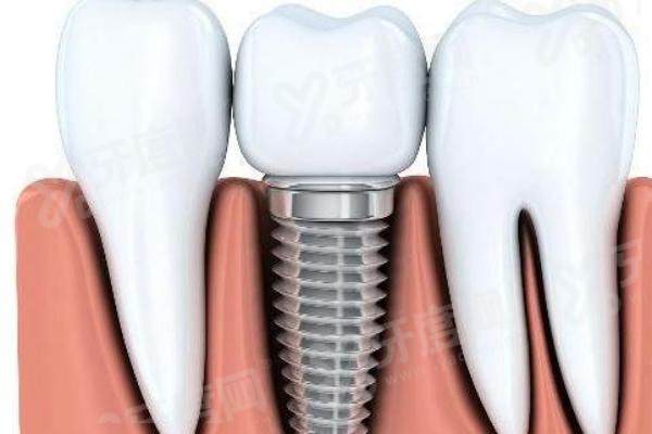 太原龙橙口腔是正规的吗？资质齐全正规，数字化种植矫正技术精湛