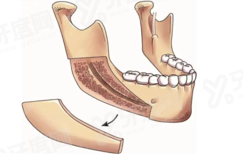 三、戴传昌医生价格表yanke.yadoo.cn