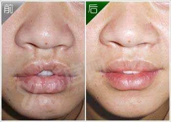 三、重庆美仑美奂整形医院怎么样yanke.yadoo.cn