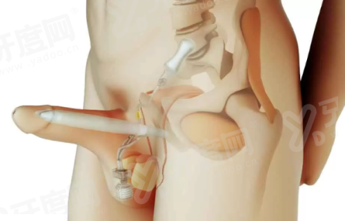 连云港灌南爱尚芙医疗美容简介：正规机构，技术靠谱附地址