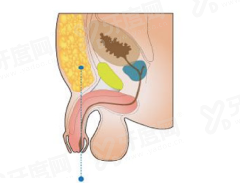 二、深圳非凡整形医院价格表yanke.yadoo.cn