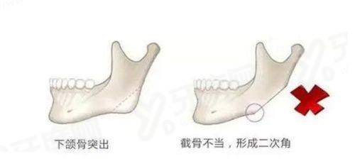 二、安徽合肥曙光植发医院价格表yanke.yadoo.cn