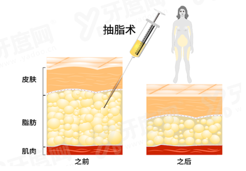 一、重庆祐美祐康医疗美容医院怎么样yanke.yadoo.cn