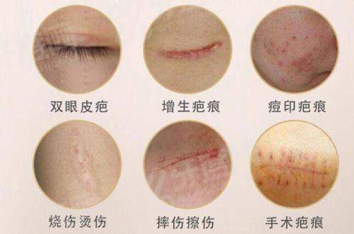 二、杭州米兰柏羽医疗美容医院价格表yanke.yadoo.cn