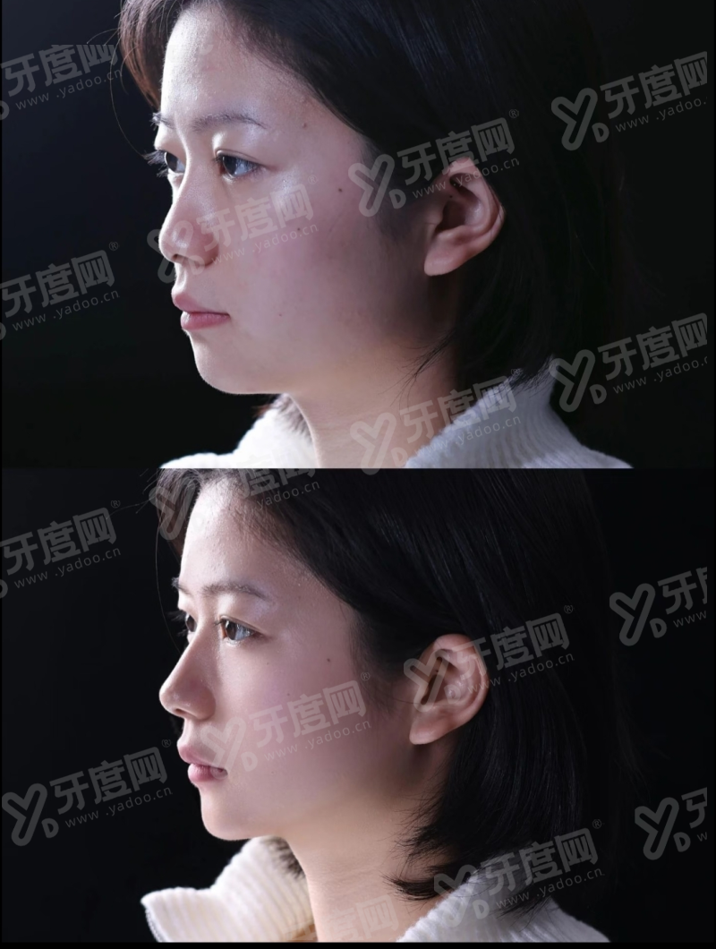 二、重庆祐美祐康医疗美容医院价格表yanke.yadoo.cn