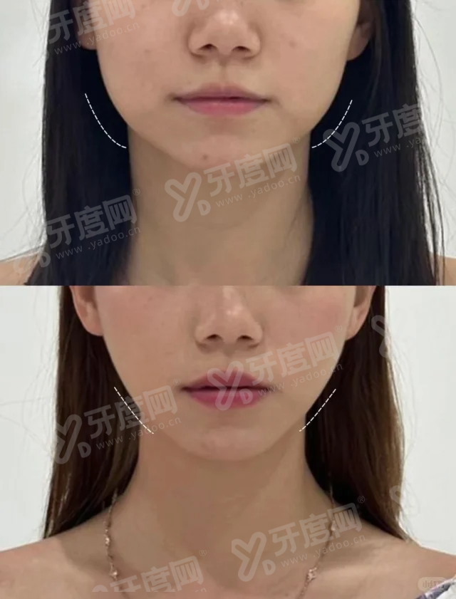 重庆美仑美奂整形医院地址在哪里？在江北区观音桥，轻轨3/9号线直达！