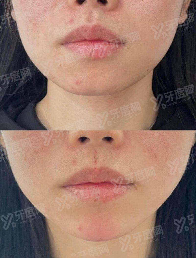 二、连云港灌南爱尚芙医疗美容医院怎么样yanke.yadoo.cn