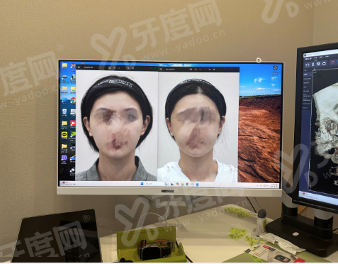 二、安徽合肥曙光植发医院怎么样yanke.yadoo.cn