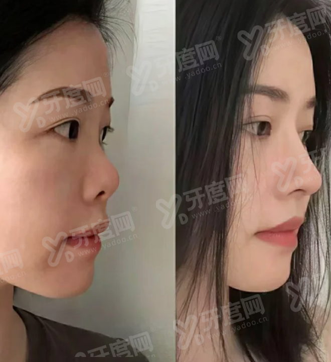 一、连云港灌南爱尚芙医疗美容简介yanke.yadoo.cn