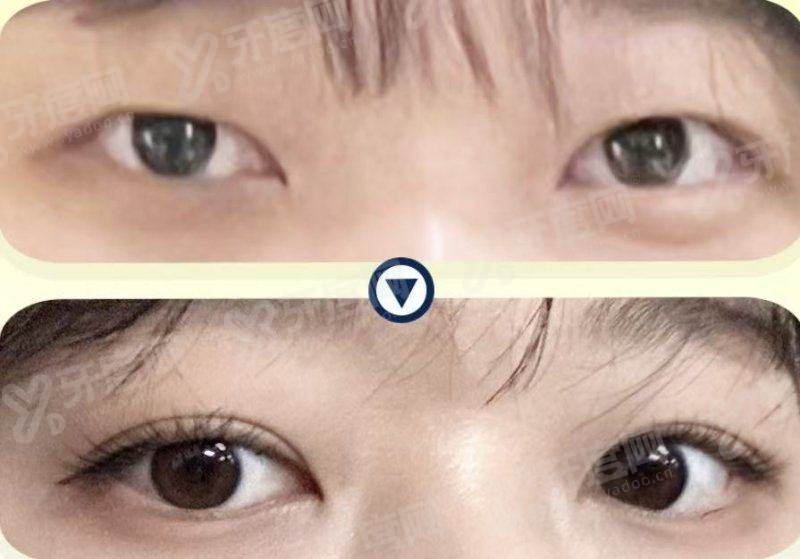 安徽合肥曙光植发医院简介：专注毛发移植效果自然，地址在蜀山区望江西路