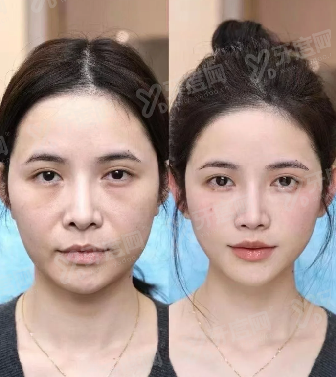 三、连云港灌南爱尚芙医疗美容医院地址在哪里yanke.yadoo.cn