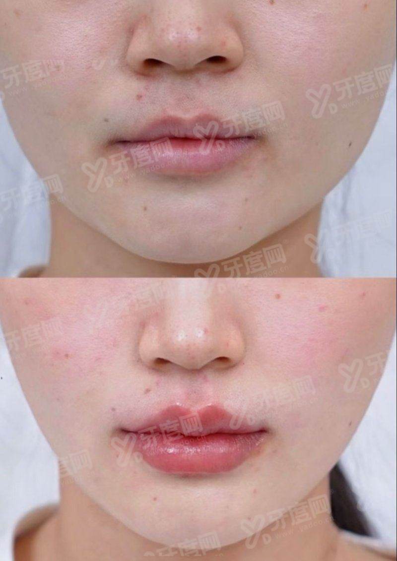 三、安徽合肥曙光植发医院地址在哪里yanke.yadoo.cn