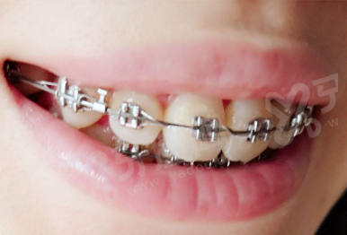 合肥蓝天贝杰口腔医院（蜀山院区）好不好？好！