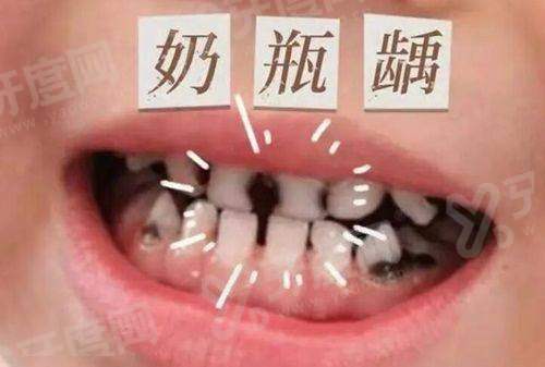 廊坊圣洁口腔医院地址电话：在广阳区爱民东道，种植矫正价格不贵