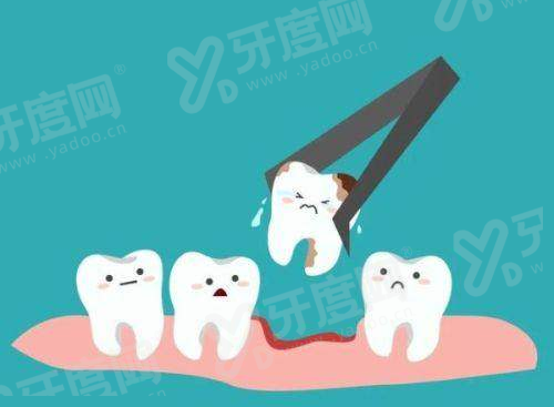 南通美奥口腔医院种植牙怎么样？数字化导板微创技术+即刻负重修复技术，价格透明无套路