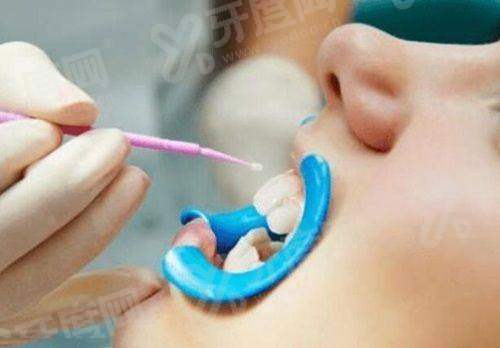 二、长沙中诺口腔医院口碑怎么样？真人实例见证立得用种植与数字化正畸魅力yanke.yadoo.cn