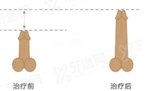 一、太原华晋整形医院如何预约挂号yanke.yadoo.cn