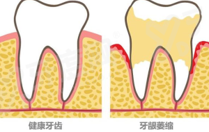 一、商洛小白兔口腔医院挂号预约yanke.yadoo.cn