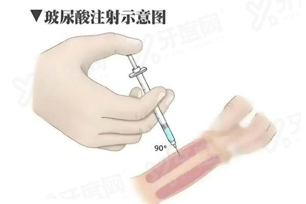 广州建国医院做延长和增粗价格高不高？费用透明合理，结合私密整形多少钱放心变强！
